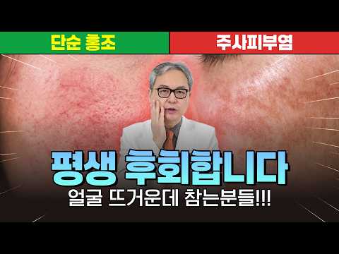 얼굴 화끈거림을 단순 홍조로 착각하면 안 되는 이유... 방치하는 순간 피부 장벽 무너집니다