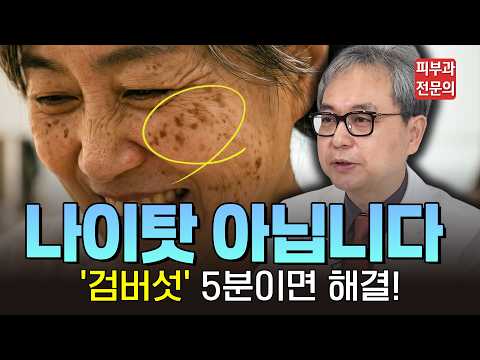 저승꽃이라 불리는 검버섯, 절대 자연적으로 안 없어집니다! 의사가 추천하는 가장 확실한 제거법과 시술 후 관리 꿀팁 #검버섯제거 #흑자제거 #검버섯