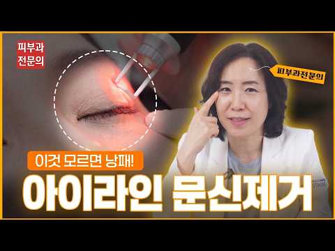 이시영님처럼 싹 지워질 줄 알았죠? 10년 된 아이라인 문신 제거 전 꼭 알아야 할 팩트